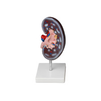 Модель почки в разрезе - «globural.ru» - Рузаевка