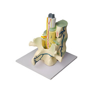 Модель части позвоночника человека - «globural.ru» - Рузаевка