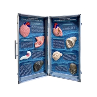 Учебно-демонстрационный кейс "Последствия употребления алкоголя и наркотиков" - «globural.ru» - Рузаевка