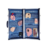 Учебно-демонстрационный кейс "Последствия употребления наркотиков" - «globural.ru» - Рузаевка