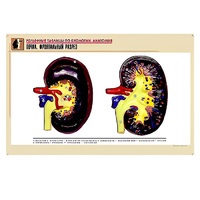 Рельефная таблица "Почка. Фронтальный разрез" (формат А1, матовое ламинир.) - «globural.ru» - Рузаевка