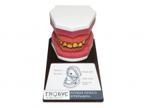 Демонстрационная модель "Ротовая полость курильщика" - «globural.ru» - Рузаевка