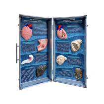 Учебно-демонстрационный кейс "Последствия употребления алкоголя и наркотиков" - «globural.ru» - Рузаевка